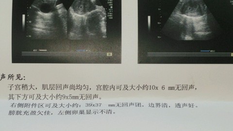 子宫内膜见多个无回声，解读与解析